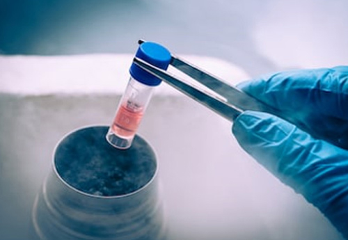 自己脂肪幹細胞療法